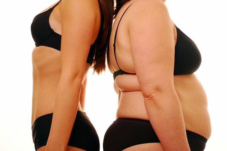 Corpo delgado e obesidade como causa de varices